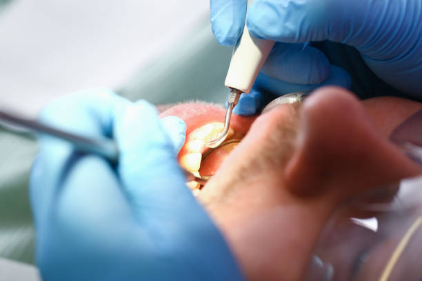 Best 24-Hour Emergency Dental Care in Passapatanzy, VA