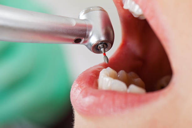 Best Emergency Pediatric Dental Care in Passapatanzy, VA